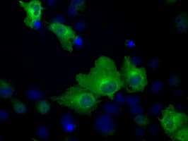 IHC-plus™ Heat Shock Protein 70 / HSPA1A Antibody (clone 5F3)