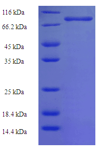 Human PIK3R5 Protein (Recombinant His-SUMO)