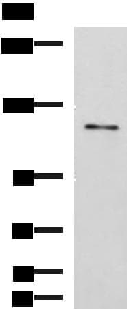 FNIP2 Antibody