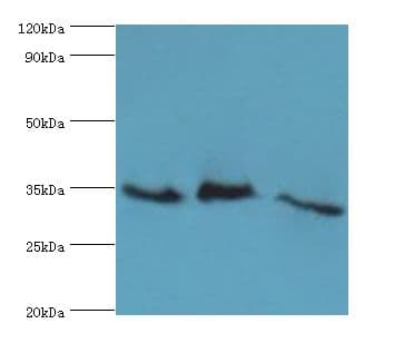 SRM / Spermidine Synthase Antibody (aa1-302)