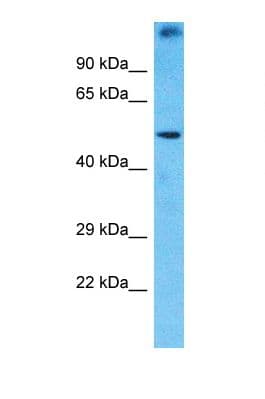 Polyclonal Rabbit anti-Human PRAMEF1 Antibody (aa118-167, WB)
