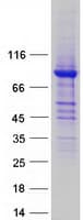Human ALDH16A1 Protein (Recombinant Myc-DDK (Flag))