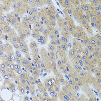SYNPO / Synaptopodin Antibody
