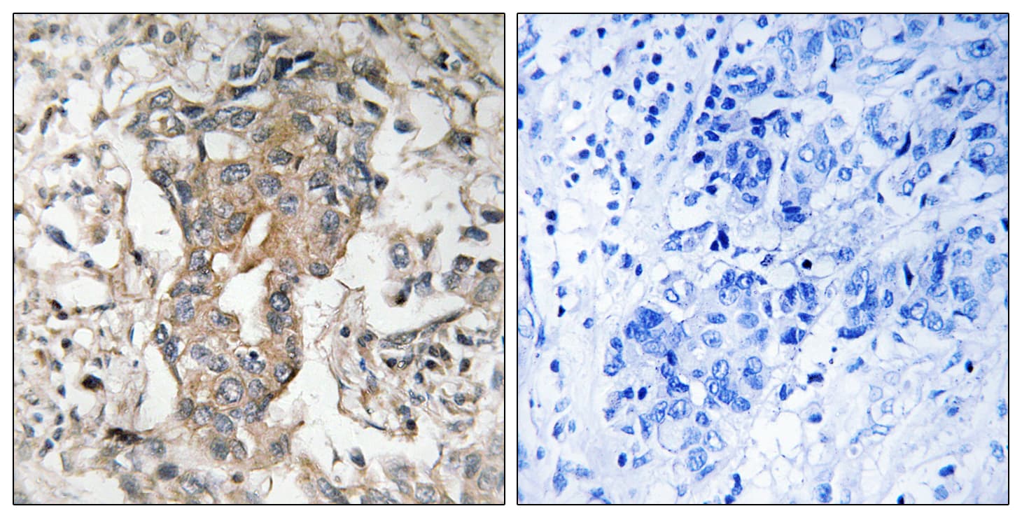 SPHK2 Antibody (aa580-629)