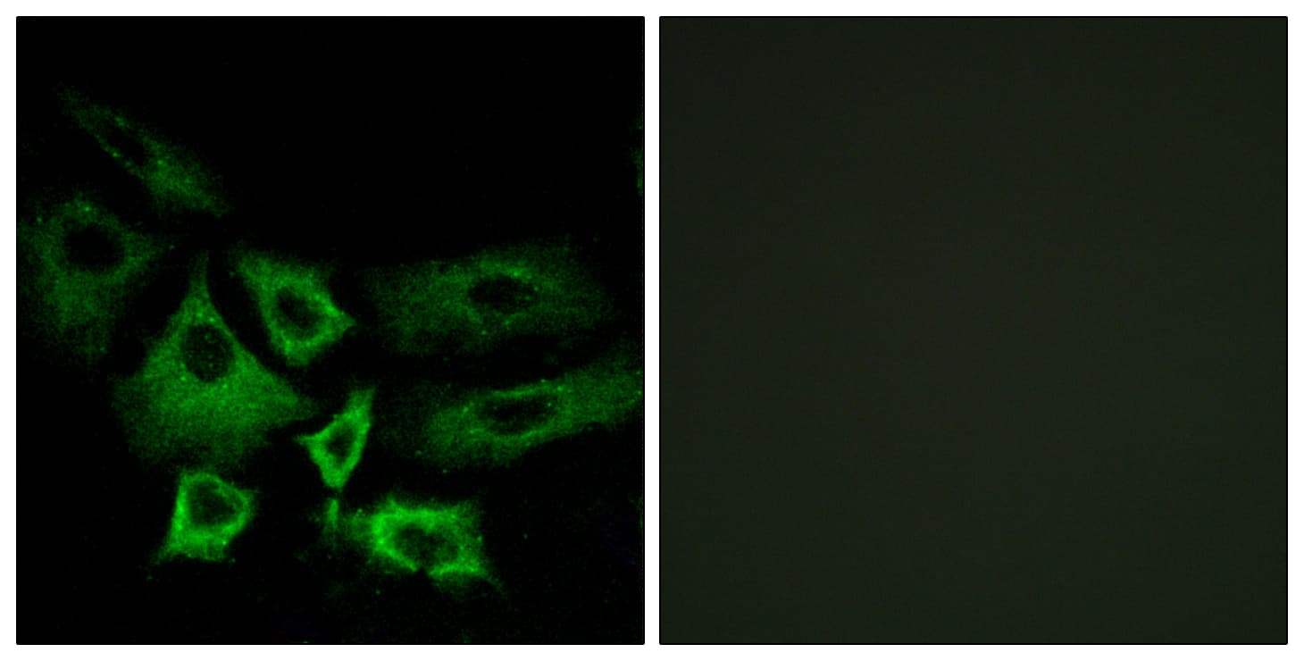 IHC-plus™ NT5C1A / CN1A Antibody (aa151-200)