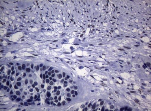 Monoclonal Mouse anti-Human SAMD12 Antibody (clone OTI2G1, IHC, WB)