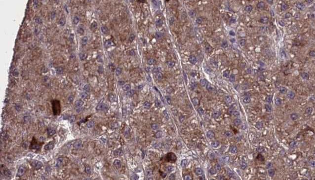 Polyclonal Rabbit anti-Human OR2H1 Antibody (IHC, WB)