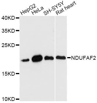 NDUFAF2 / NDUFA12L Antibody