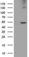 LPL / Lipoprotein Lipase Antibody (aa28-475, clone OTI2C12)