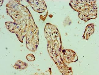 Polyclonal Rabbit anti-Human BANP Antibody (aa1-260, IHC, WB)