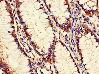 PANK2 Antibody