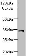 IHC-plus™ Polyclonal Rabbit anti-Human ZDHHC3 Antibody (IHC, WB)