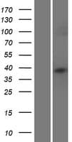HLA-DRB3 Protein (Over-Expression Lysate Myc-DDK (Flag))