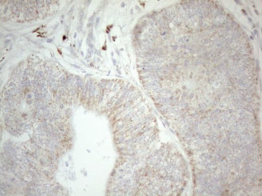 Monoclonal Mouse anti-Human NAPSA / NAPA / Napsin A Antibody (clone OTI3C6, Carrier-free, aa64-244, IHC)