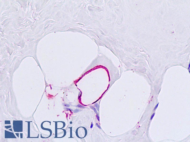 IHC-plus™ Polyclonal Rabbit anti-Human GCGR / Glucagon Receptor Antibody (N-Terminus, IHC)
