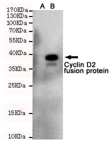 CCND2 / Cyclin D2 Antibody