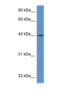 ZDHHC11 Antibody (aa100-149)