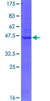 Human BTBD11 Protein (Recombinant GST)