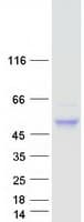 Human CNOT11 / C2orf29 Protein (Recombinant Myc-DDK (Flag))