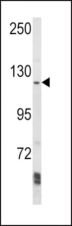 Polyclonal Rabbit anti-Human AAK1 Antibody (aa186-216, WB)