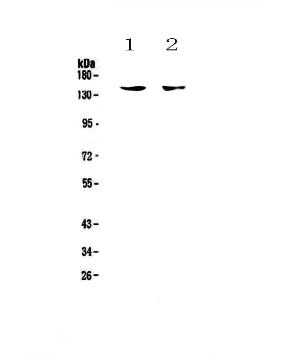Polyclonal Rabbit anti-Human ITGAX / CD11c Antibody (IHC, WB)
