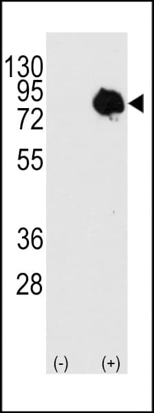 TGM2 / Transglutaminase 2 Antibody (Thr428)