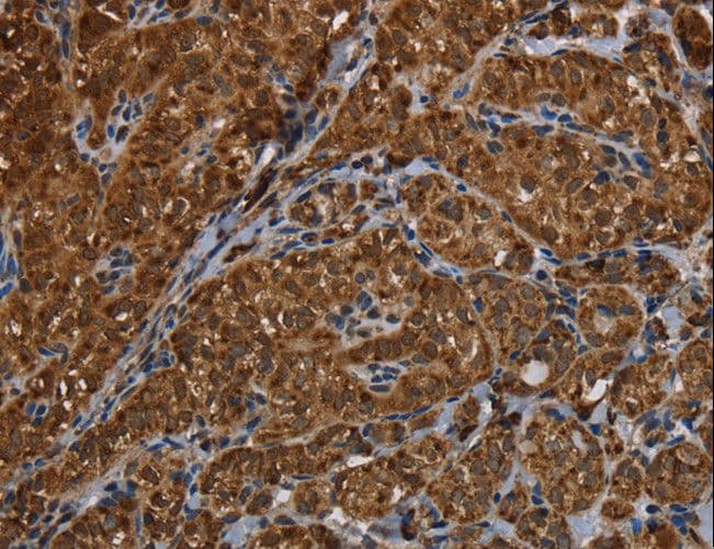 Polyclonal Rabbit anti-Human HSD17B13 Antibody (IHC, WB)
