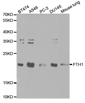 Polyclonal Rabbit anti-Human FTH1 / Ferritin Heavy Chain Antibody (IHC, IF, WB)