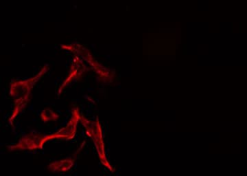 ZAP70 Antibody
