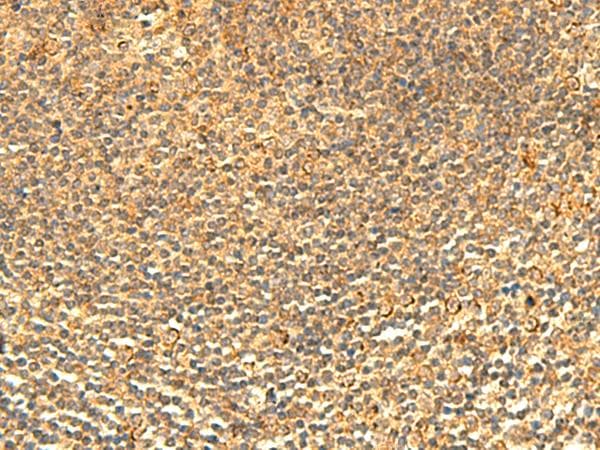 Polyclonal Rabbit anti-Human ABHD10 Antibody (IHC)