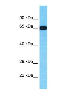 TTC22 Antibody (aa146-195)