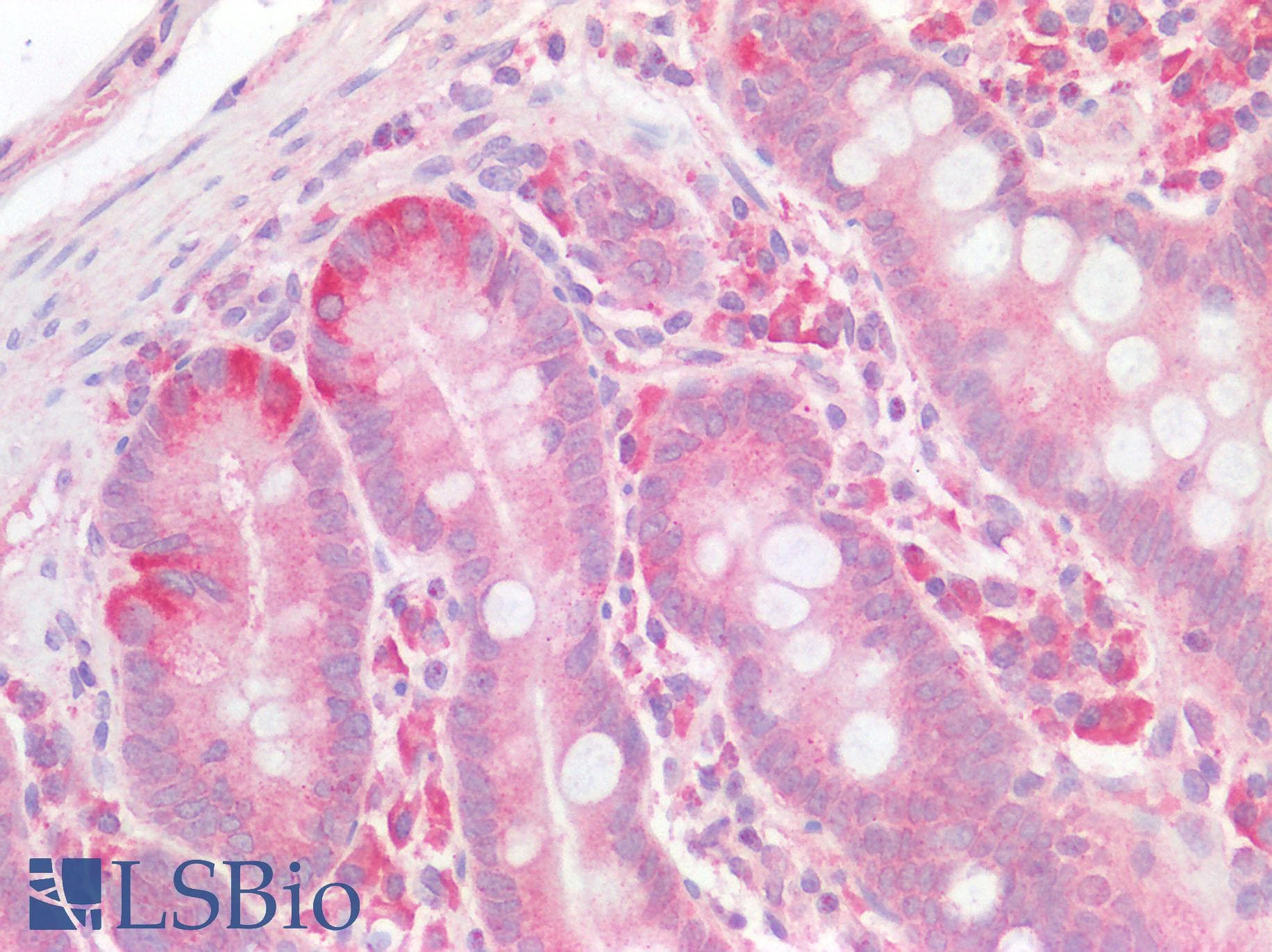 CSF2RA / CD116 Antibody (clone 2G5)