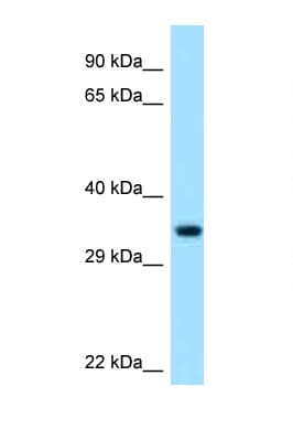 Polyclonal Rabbit anti-Human PECR Antibody (C-Terminus, WB)