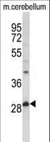 Polyclonal Rabbit anti-Human PPT1 / CLN1 Antibody (aa32-63, WB)