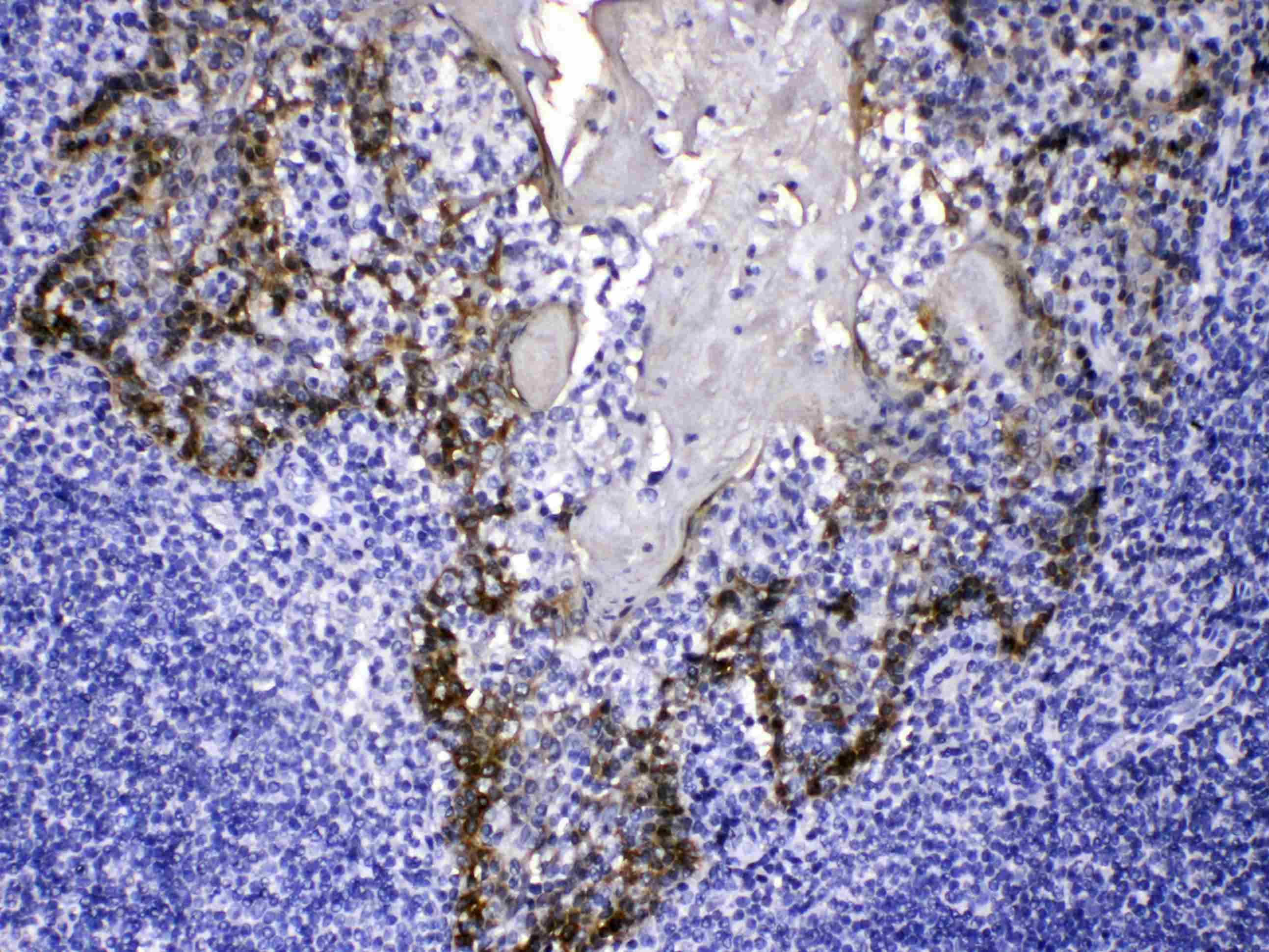 KRT14 / CK14 / Cytokeratin 14 Antibody