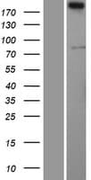 SERTAD3 Protein (Over-Expression Lysate Myc-DDK (Flag))