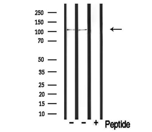 PDE2A Antibody