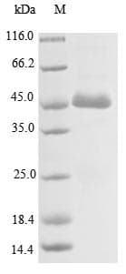 Human ACTL8 Protein (Recombinant 6His, N-terminus + Myc, C-terminus)