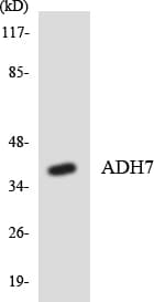 ADH7 Antibody (aa184-233)