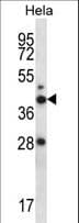 RAD23A / HHR23A Antibody (aa42-70)