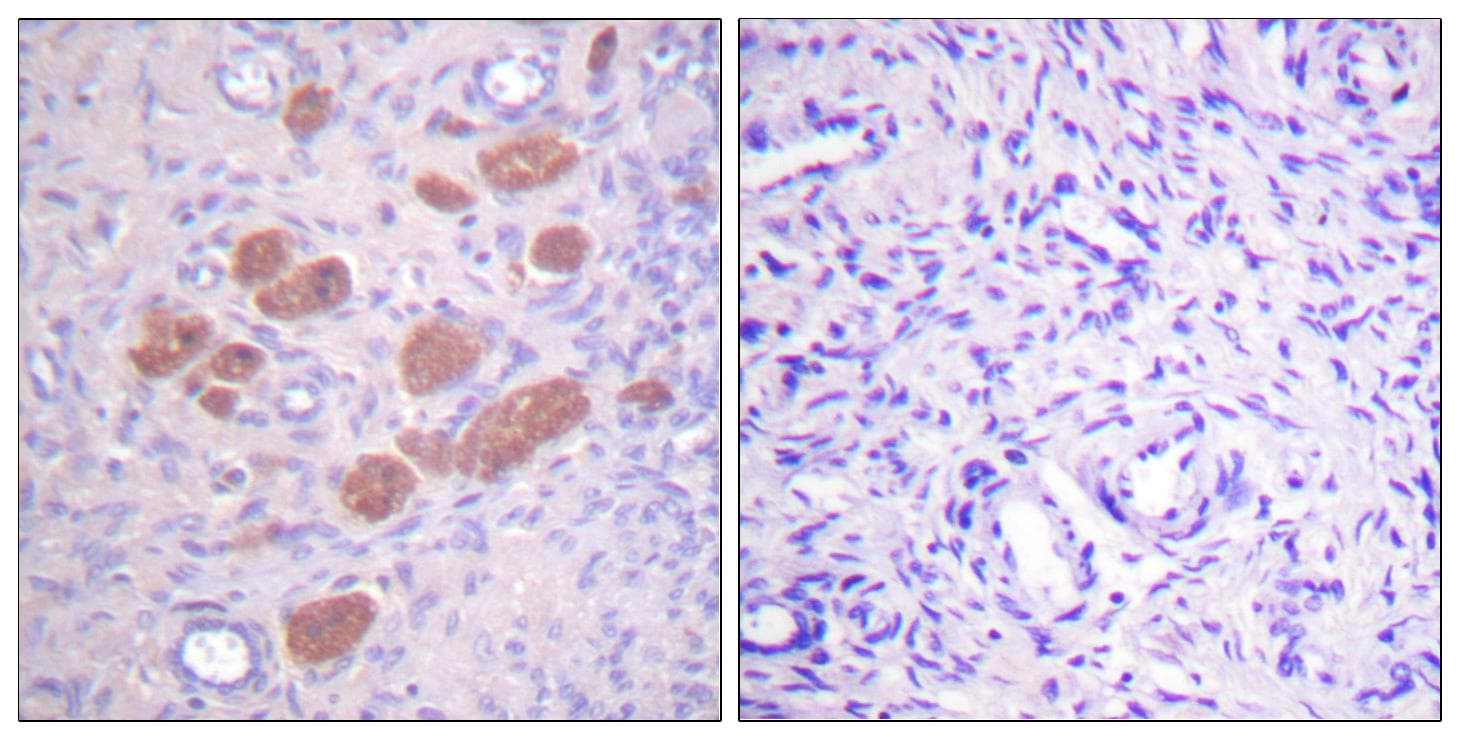 P40PHOX / NCF4 Antibody (phospho-Thr154)