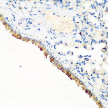 c-CBL Antibody