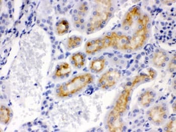 Polyclonal Rabbit anti-Human CYP24 / CYP24A1 Antibody (aa153-514, IHC, WB)