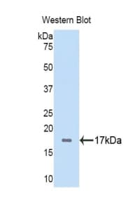 FGA / Fibrinogen Alpha Antibody (aa124-214, Biotin)
