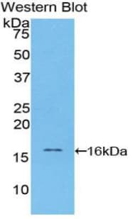 CST4 / Cystatin S Antibody (aa21-141)