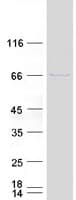 Human GALNT6 Protein (Recombinant Myc-DDK (Flag))