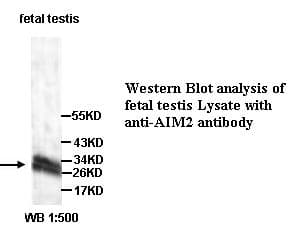 Polyclonal Rabbit anti-Human AIM2 Antibody (Internal, IHC, WB)