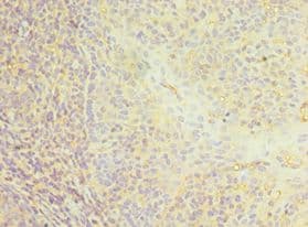 Polyclonal Rabbit anti-Human CD22 Antibody (aa708-847, IHC)