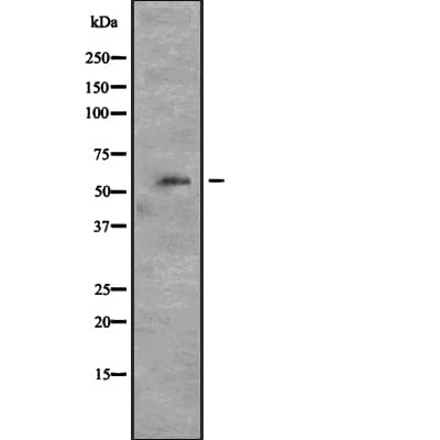 CDK8 Antibody