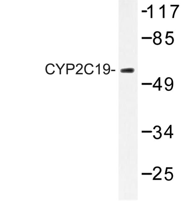 CYP2C19 Antibody (Lys270)